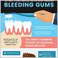 how long does it take for gums to stop bleeding