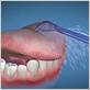 how often to waterpik teeth