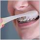 how to brush braces with an electric toothbrush