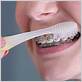how to brush your braces with an electric toothbrush