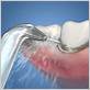 how to clean back of teeth with waterpik