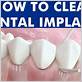 how to clean dental implants at home