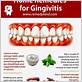 how to cure gingivitis in a week at home