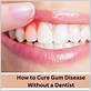 how to cure gum disease without a dentist uk