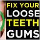 how to fix loose teeth from gum disease at home