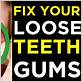 how to fix loose teeth from gum disease home remedies