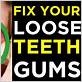 how to fix loose teeth from gum disease uk
