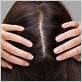how to get a healthy scalp naturally