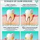 how to get rid of mild gum disease