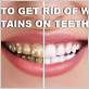 how to get rid of teeth stains