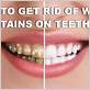 how to get white stains off of teeth