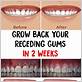 how to grow gum disease