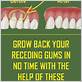 how to help gums heal