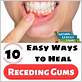 how to improve gum disease naturally