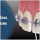 how to make dental floss braces
