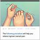 how to place dental floss under an ingrown toenail
