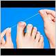 how to place dental floss under ingrown toenail