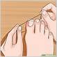 how to place waxed dental floss under ingrown toenail