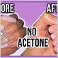 how to remove acrylic nails without acetone or dental floss