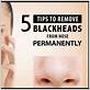 how to remove blackheads on nose with toothbrush