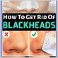 how to remove blackheads with a toothbrush