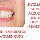 how to remove swelling from gums