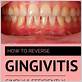 how to reverse gingivitis