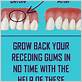 how to soothe gums