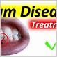 how to stop gum disease fast