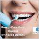 how to stop gum disease without dentist