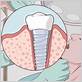 how to stop periodontitis