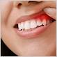 how to take care of inflamed gums