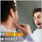 how to tighten teeth durring gum disease
