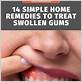 how to treat an inflamed gum