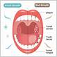 how to treat bad breath from gum disease