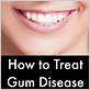 https www.earthclinic.com homemade-tooth-products-for-gum-disease.html