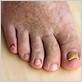 infected toenail water flosser