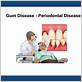 interesting quiz about gum disease