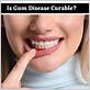 is a gum disease curable
