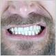 is bruxism related to gum disease