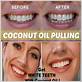 is coconut oil pulling good for gum disease