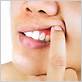 is coenzyme q10 good for gum disease