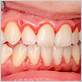 is gum disease communicable