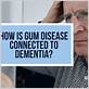 is gum disease connected to alzheimer's