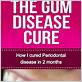 is gum disease ever cured