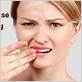 is gum disease heratitare