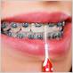 is it better to use an electric toothbrush with braces