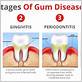 is it possible to cure gum disease