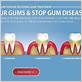 is severe gum disease reversible