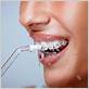 is the waterpik as good as flossing for small kids